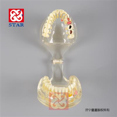 病理修復模型M4019