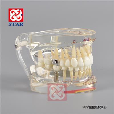 病理修復模型M4019-2