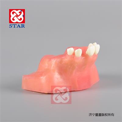 種植切開縫合練習可用超聲骨刀練習仿骨質