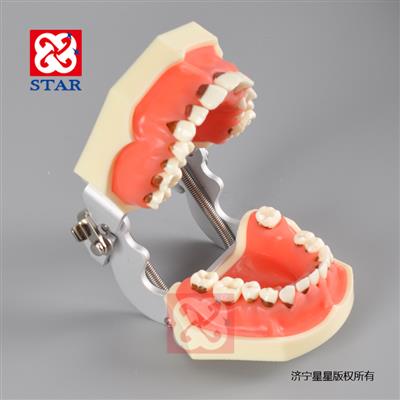 練習刮治縫合特點是3區6缺失牙齒牙齦可更換