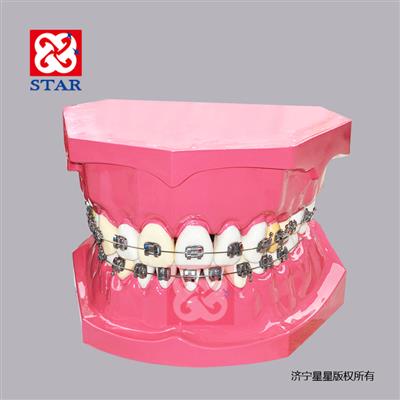 10倍標(biāo)準(zhǔn)正畸模型M7035