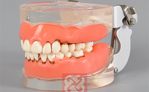 口腔醫(yī)療器械行業(yè)發(fā)展現(xiàn)狀